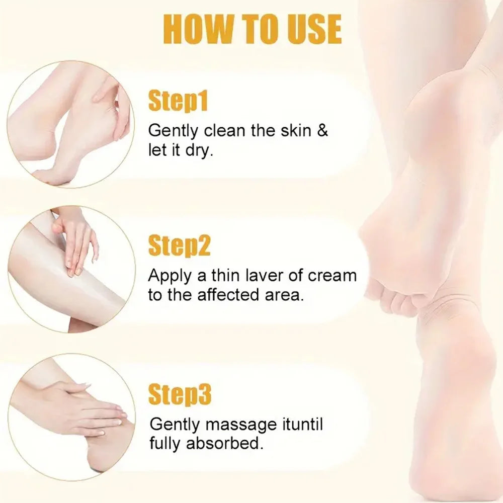 Foot Cream for Dry Cracked Feet Heels Knees Hands